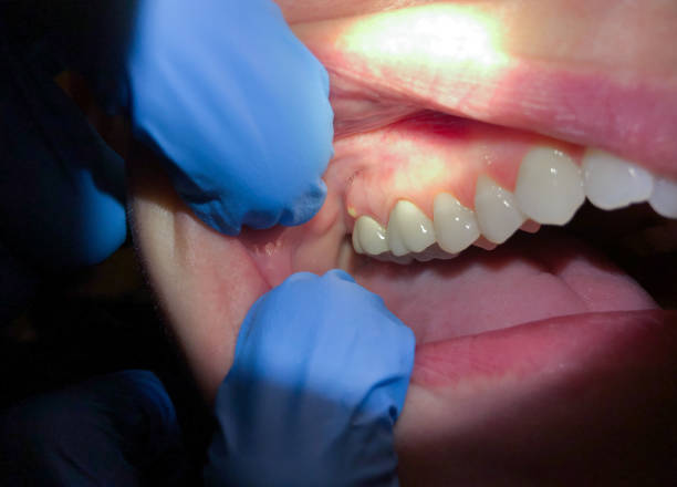 Best Weekend Emergency Dentist in River Edge, NJ
