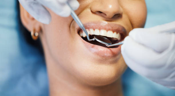 Best Emergency Gum Treatment in River Edge, NJ
